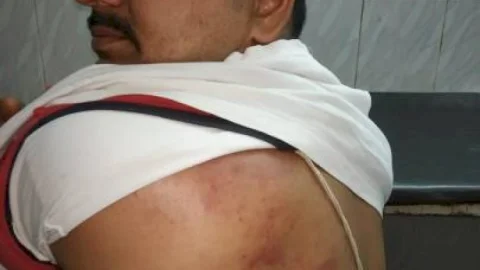 धनबाद: सुदामडीह में रघुकुल व ददई समर्थक भिड़े, पुरानी रंजिश व बीसीसीएल आवास कब्जा करने को लेकर विवाद, पुलिस में कंपलेन