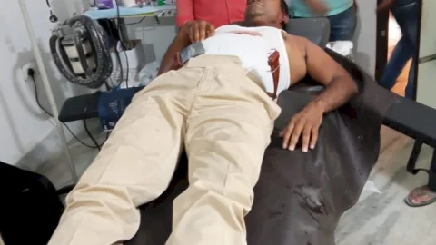 धनबाद: भेलाटांड़ में जमीन विवाद की जांच को पहुंची बरवाअड्डा पुलिस पर हमला, थानेदार समेत तीन पुलिसकर्मी जख्मी