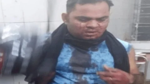 जमशेदपुर: उलीडीह में क्रिमिनलों ने ज्वेलरी बिजनसमैन को मारी गोली, पुलिस ने नहीं लिया था कंपलेन