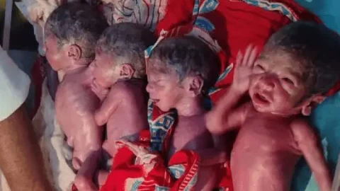 बिहार: सिवान की महिला ने दिया एक साथ पांच बच्चों को जन्म, तीन लड़कियां और दो लड़के