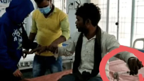 उत्तर प्रदेश: महोबा में हाथ में सांप लेकर हॉस्पीटल पहुंच गया युवक, बोला- ओ डाक्टर साहेब जा सांप ने हमो डसो है...