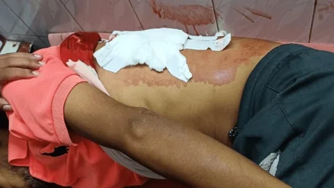 Dhanbad :  चासनाला में रिकवरी एजेंट को गोली मार पांच लाख रुपये की  लूट 