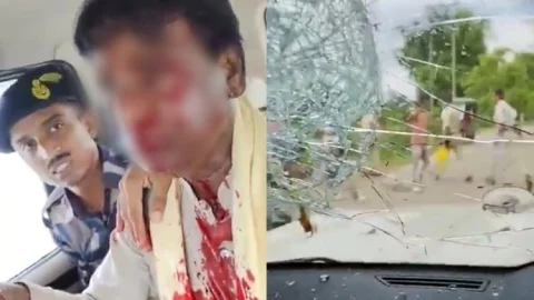 पश्चिम बंगाल में बीजेपी सांसद खगेन मुर्मू पर जानलेवा हमला, सिर फूटा; भीड़ ने गाड़ियों पर बरसाये पत्थर