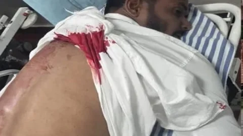 धनबाद में नमाज के बाद गोलियों की गूंज! वासेपुर में इकबाल खान के ड्राइवर पर फायरिंग, इलाके में दहशत