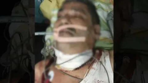 धनबाद में कोयला कारोबारी को लगी गोली, घर में चली लाइसेंसी पिस्टल; आईसीयू में जिंदगी-मौत से जूझ रहे दीपक शर्मा